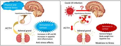 Hypothalamic adrenal insufficiency mechanism, before and after Covid-19 infection